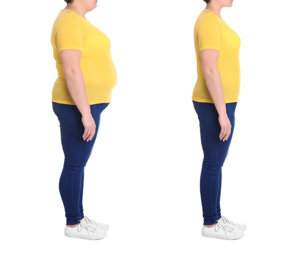 collage photos woman before after 600nw 2029427741